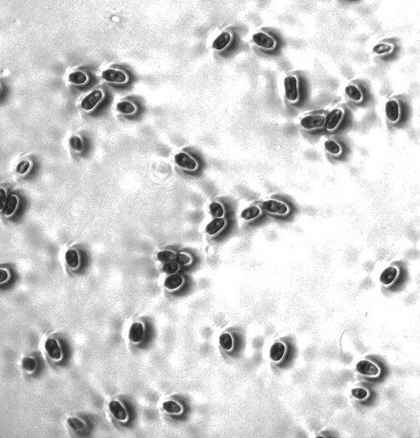 Candidiasis: infecciones por hongos